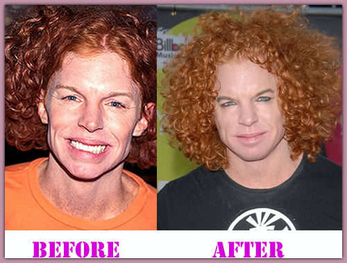 Carrot Top Before and After | Khaleej Mag - News and Stories from ...