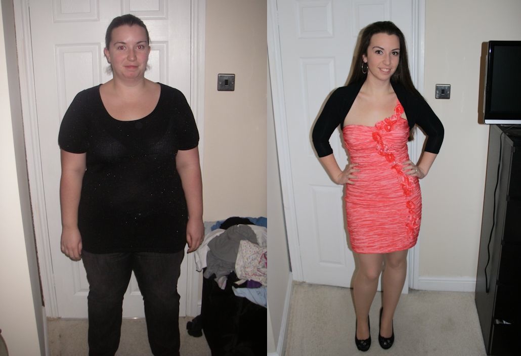 Gastric Sleeve Before And After Khaleej Mag 5600